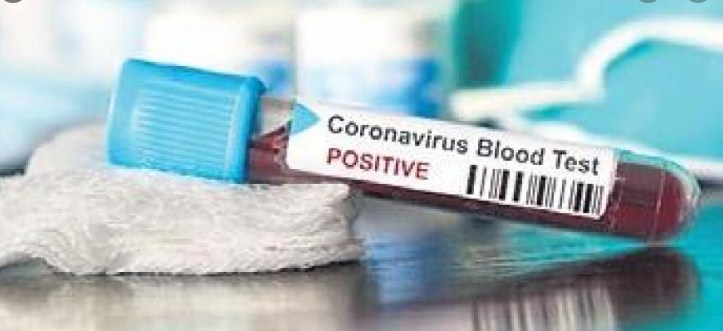 366 Fresh Covid-19 Cases Reported In J&K